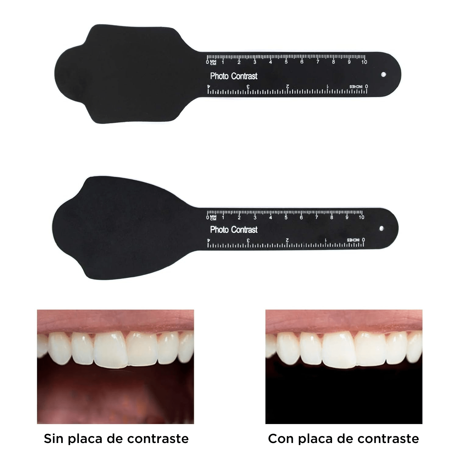 Kit de placas de contraste para fotografía intraoral (6pzas)